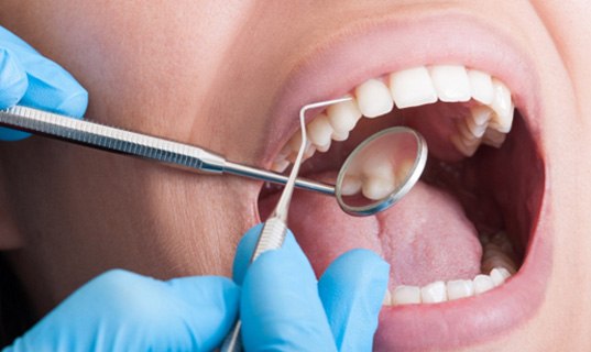 : A dentist using dental tools to perform a checkup on a woman 