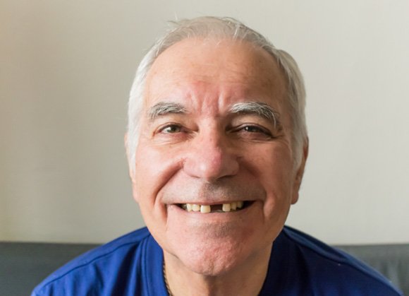 Patient in Mount Prospect smiling with missing tooth